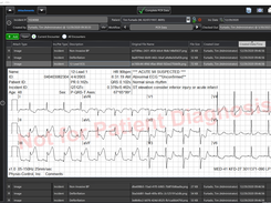 Cardiac Monitor Integration