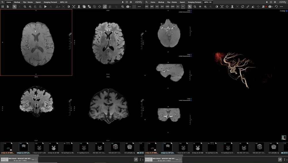 Mach7 Screenshot 1