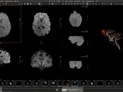 Mach7 Screenshot 1