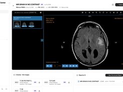 MiniPACS Screenshot 1