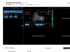 MiniPACS Screenshot 1