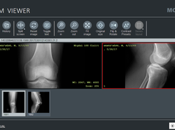 MODALIZER+ Free DICOM Viewer
