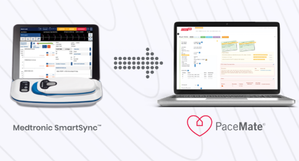 PaceMate Screenshot 1