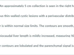 Scrollable RadPhrases-style list of liver-related shortcut labels and truncated radiology report phrases.