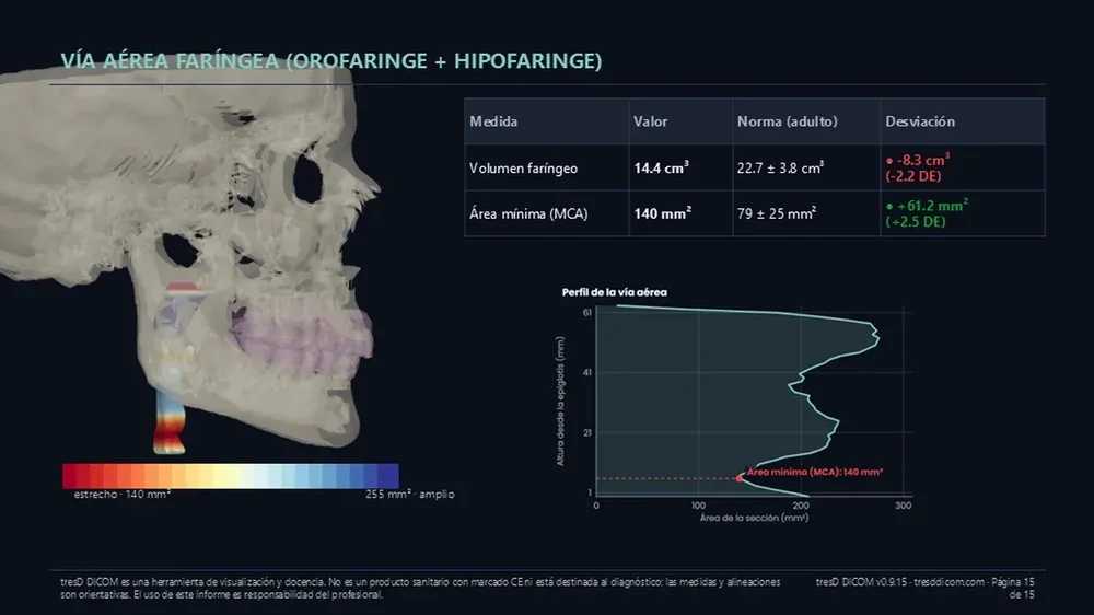 A Spanish airway-analysis report showing a lateral skull rendering, pharyngeal volume and minimum-area values, and an airway profile chart.