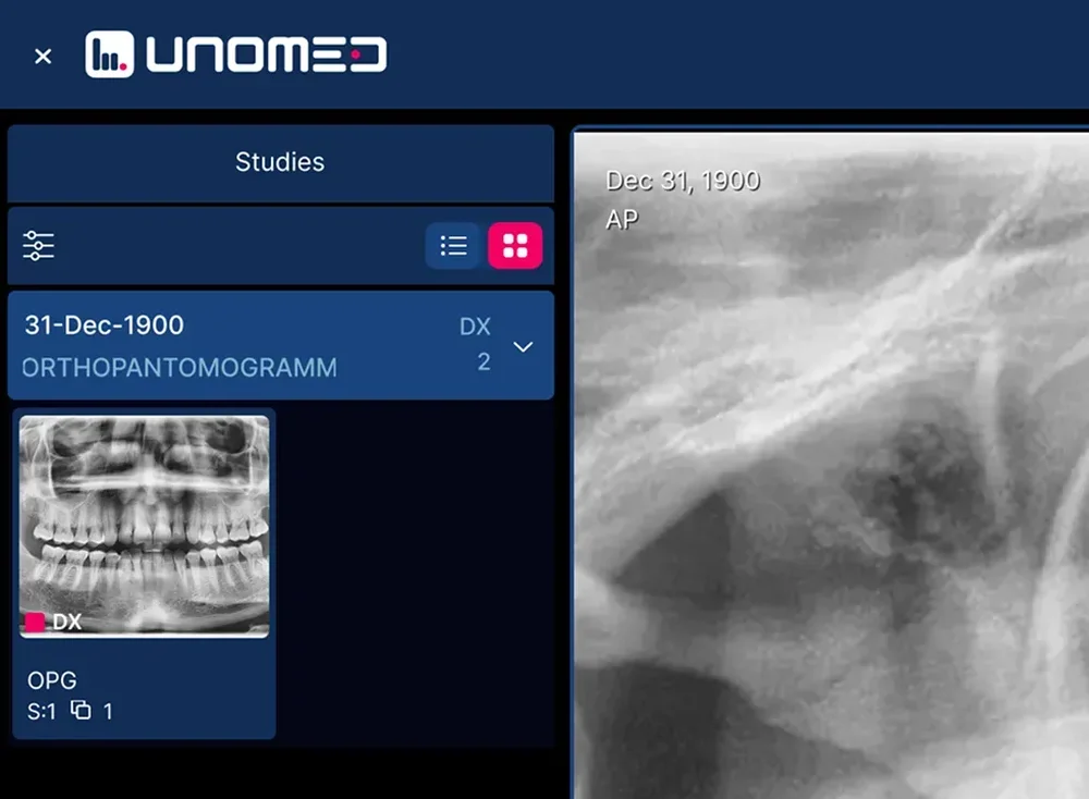 Cropped Unomed viewer showing a dental study card with a panoramic radiograph thumbnail beside a magnified dental image.