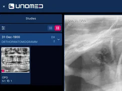 Cropped Unomed viewer showing a dental study card with a panoramic radiograph thumbnail beside a magnified dental image.